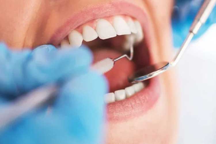 “ฟันคุด” คืออะไร อันตรายไหม ต้องผ่าตอนไหน